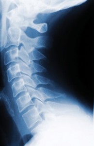 neck x-ray